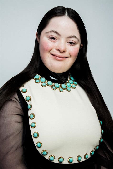 Model with Down syndrome in Gucci 'Unconventional 